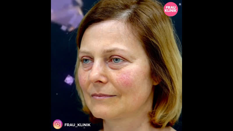 Klinik porn video – Блефаропластика в frau klinik