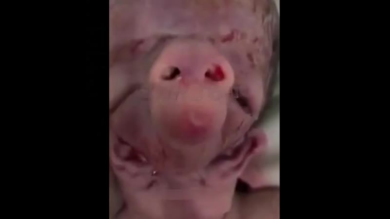 Аномальный ребенок из баку