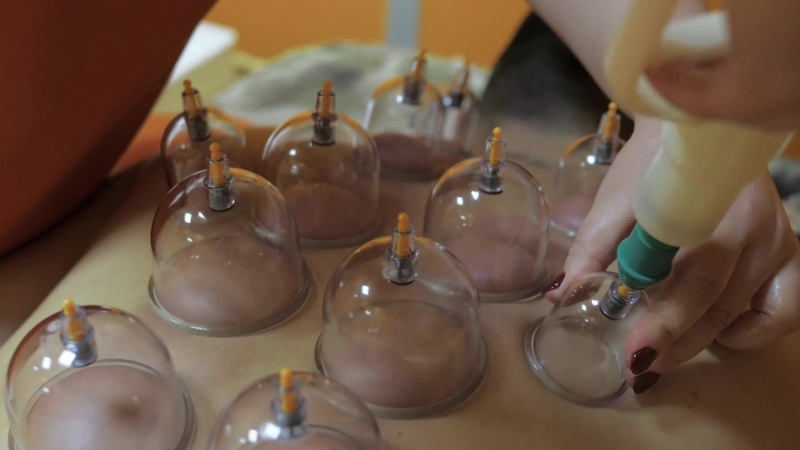 Медицинские вакуумные банки