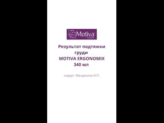 Результат операции, motiva ergonomix