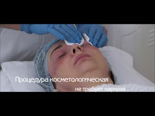 Лазерная блефаропластика в lara med clinic