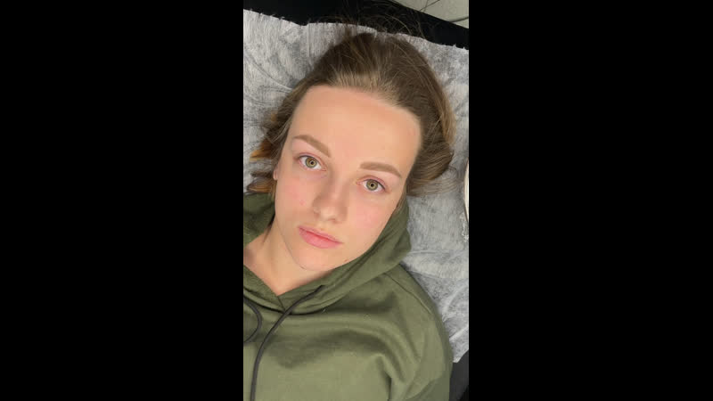 Зажившие брови и свежая межресничка💔