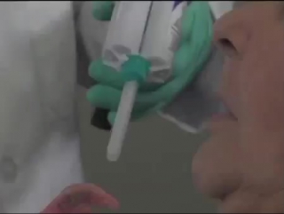 Massad tray tissue stops for mandibular impression