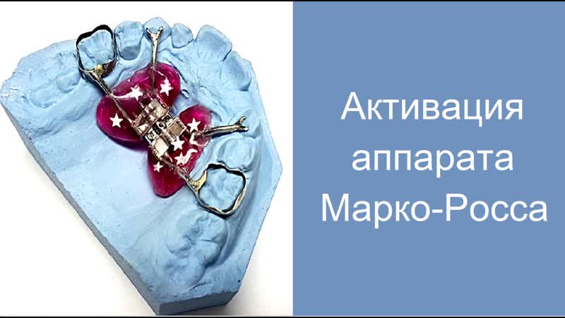 Активация винта аппарата haas/марко росса ортодонт виталий