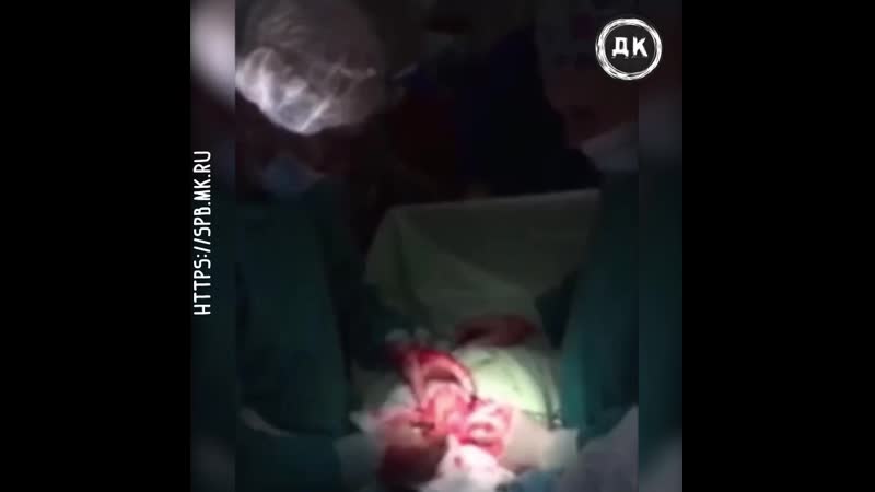 Вытащили огромный фаллос из задницы | дерзкий квадрат