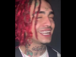 2 grillz in 1 week rose gold invisible set by lil pump