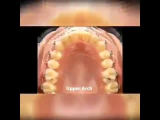 Вот это изменение!