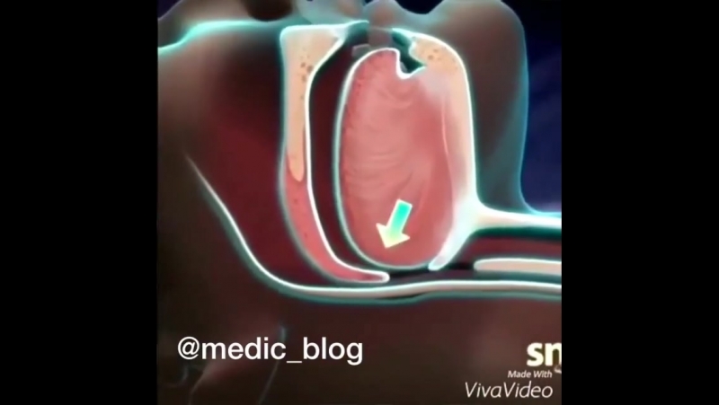 Храп возникает из за того что