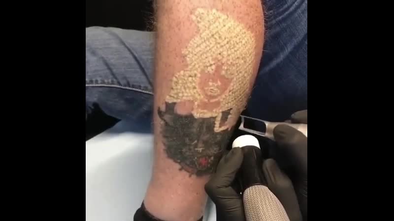 Удаляем тату