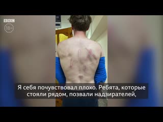 Пытались молодые дубинкой врачи и пациенты о действиях силовиков в беларуси