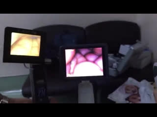 Hugemed video laryngoscope wins