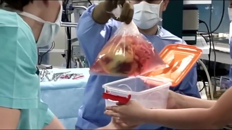 (+21) шок! кривавий бізнес на донбасі