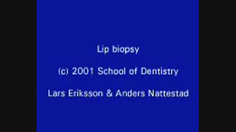 Биопсия губы (английский)