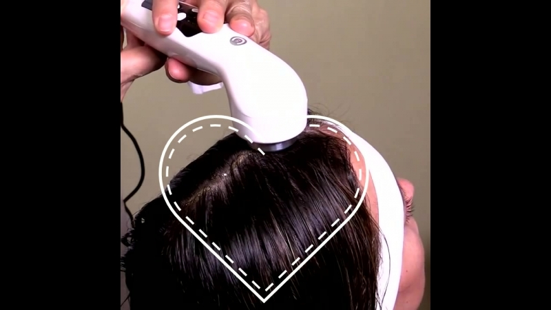 Озон процедуры против выпадения волос