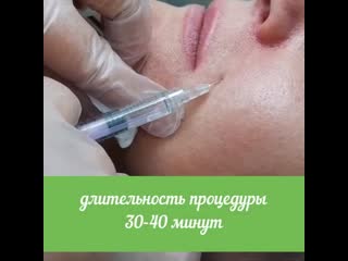 Коррекция носогубных складок филлером yvoire