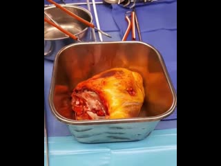 Это сердце бьется спонтанно само по себе!