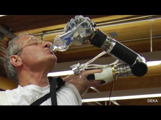 Fda approves luke skywalkers prosthetic arm