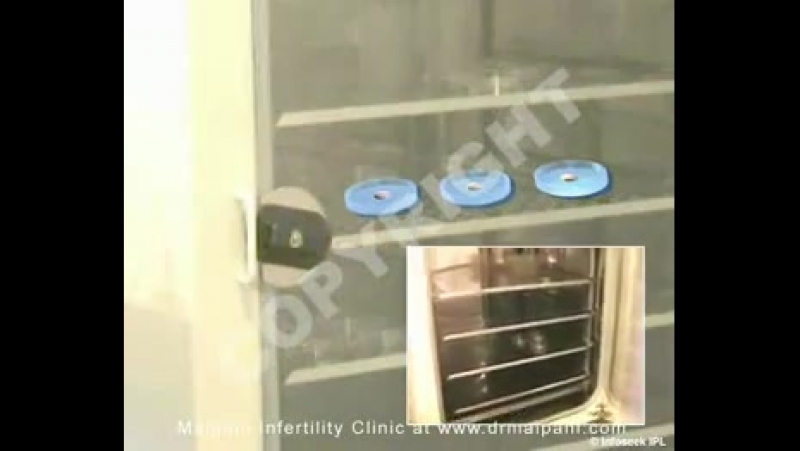 Экстракорпоральное оплодотворение