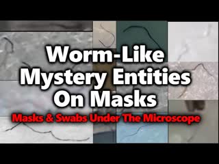 Moving black strings on masks & swabs parasites? morgellons? worm like micelles for porn delivery?