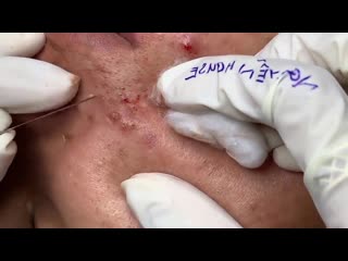 Множество угрей