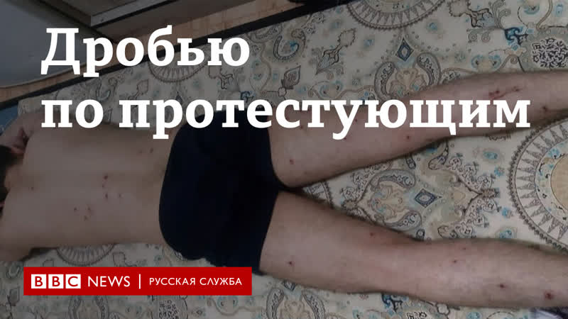 Протесты в иране почему раненые боятся обращаться к врачу?