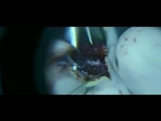 Таксидермия taxidermia часть 2 (2006)