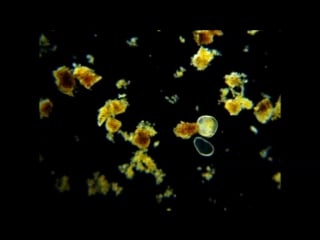 Water flea having a snack