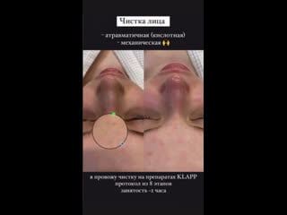 Украиналық қыздардың жеке порно фотосуреттері