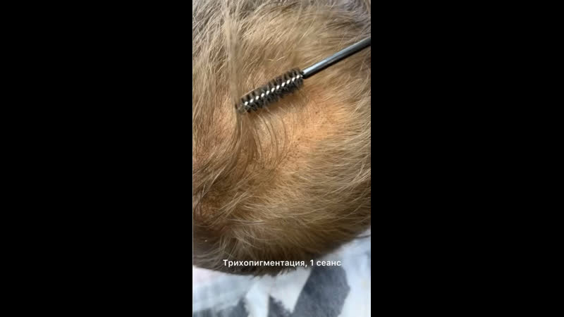 Трихопигментация,1 сеанс