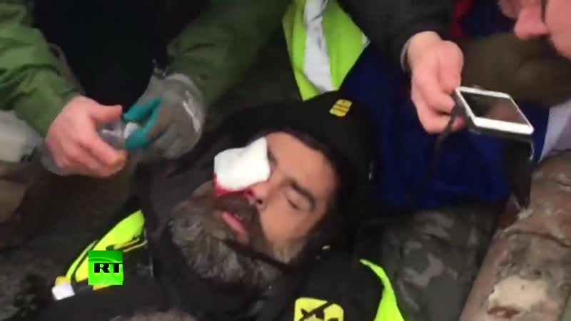 Раненный участник жёлтых жилетов