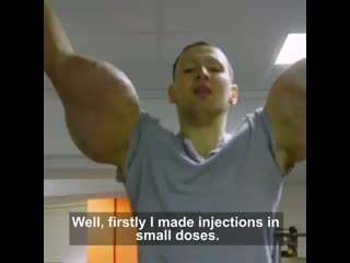 22 year old kirill has the biggest arms in russia after he injected 6 litres of oil into his biceps 💪 mp4