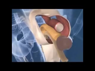 Операция по смене пола