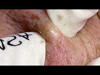 Выдавливания крупно