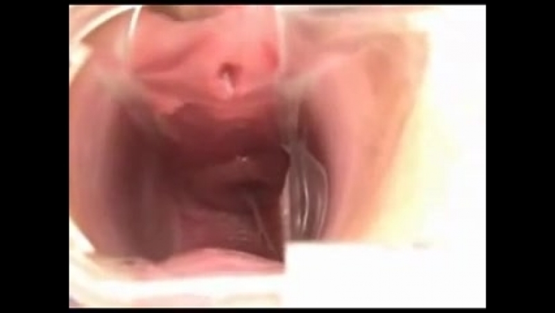 Секс видео камера внутри влагалища