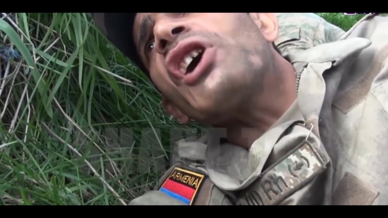 Нагорный группа армянского телевидения попала под огонь снайпера,тяжелое ранение получил один из репо