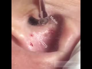 Белые штуки в ушах