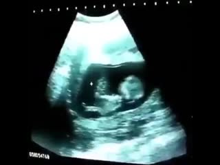 Развлечения в утробе