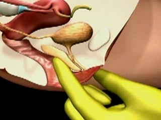 Расположение точки g