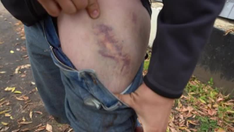 "связанные руки, запах мочи и ночь на холодном газоне" жесть во время задержаний в белоруссии