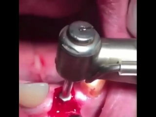 А как вы относитесь к стоматологам?