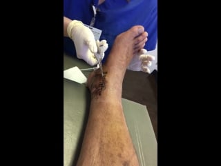 Правая нога блэка