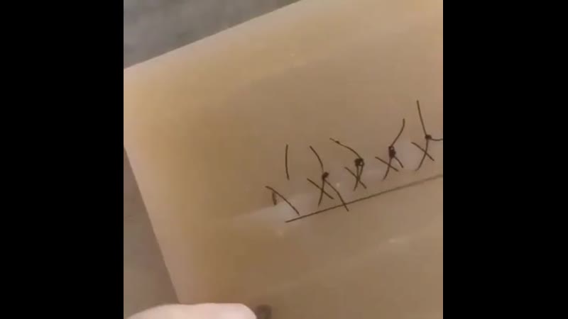 Наложение швов