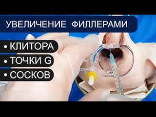 Увеличение клитора, точки g, сосков филлерами контурная пластика гиалуроновая кислота