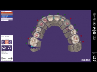 Exocad quick guide the chain mode feature [full hd,1080p]