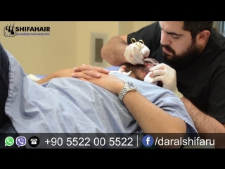 Фрагмент пересадка волос +905522005522 mp4