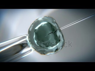 Stock footage animation of in vitro fertilization