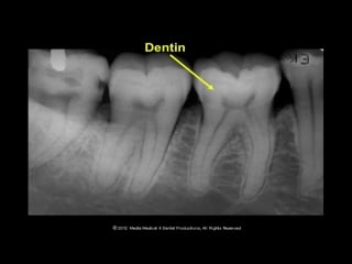 Oral radiology lecture teeth and their supporting structures (part 1)