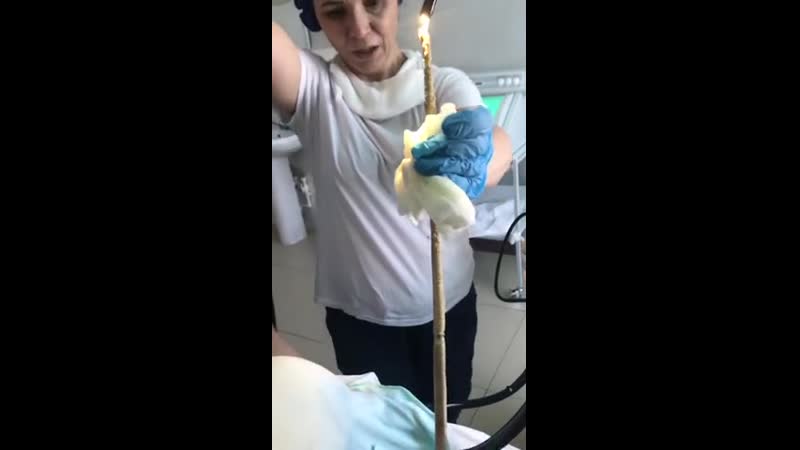 Достают огромного паразита из желудка