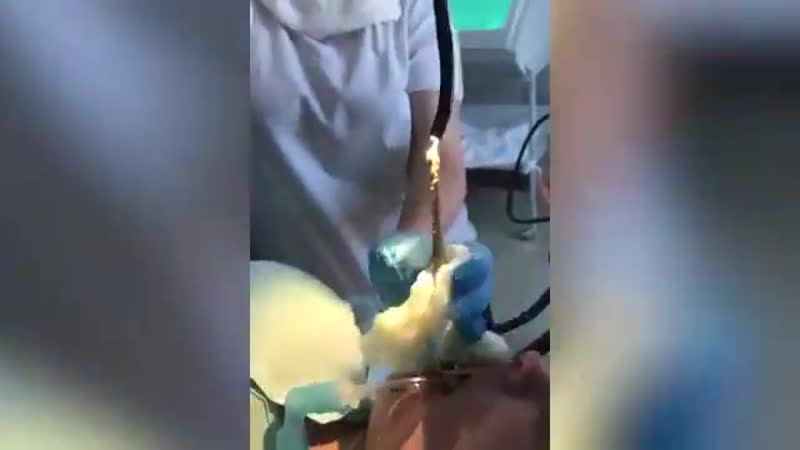 Жительница дагестанского села леваши уснула под деревом и ей в рот заползла метровая змея