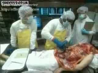 Вскрытие трупа 1